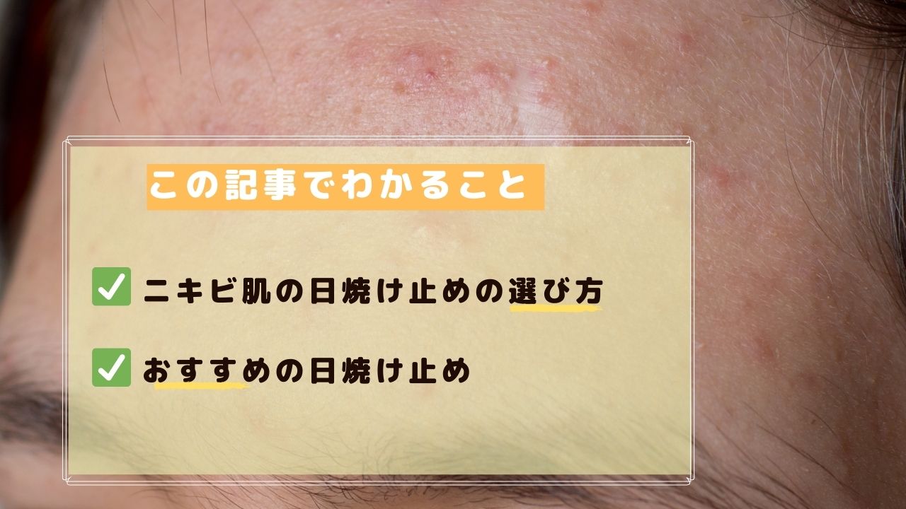 メンズ向けにニキビ肌におすすめの日焼け止めを紹介する ニキビ肌のメンズ必見 おすすめの日焼け止めを紹介